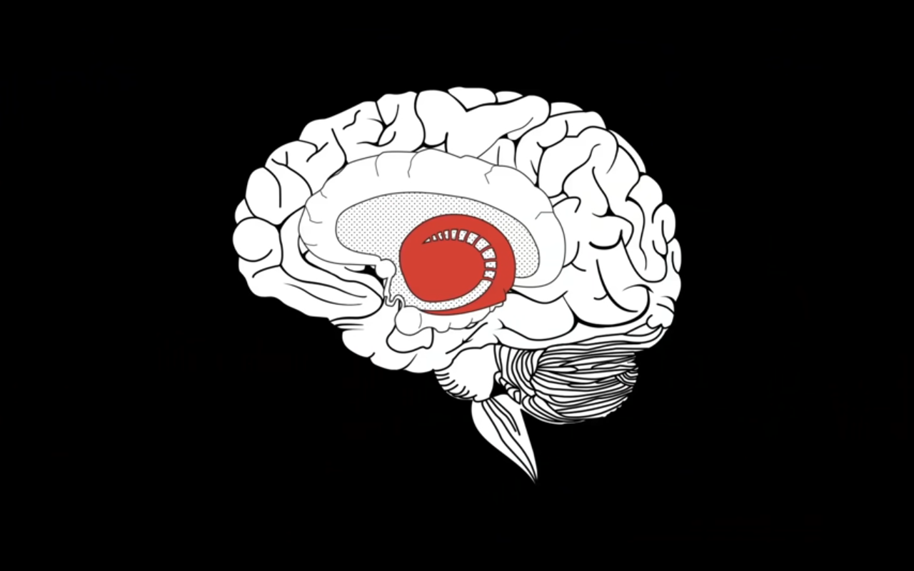 NOTRE CERVEAU CAUSERA-T-IL NOTRE  PERTE ?