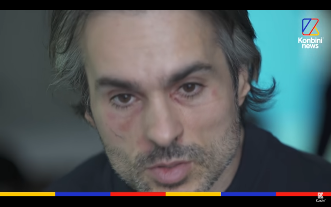 AUTISME, UNE ALTERNATIVE À L&rsquo;ENFER